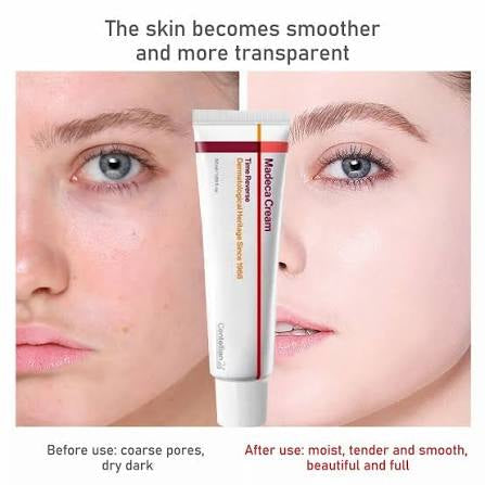 Centellian24 Madeca Cream Time Reverse