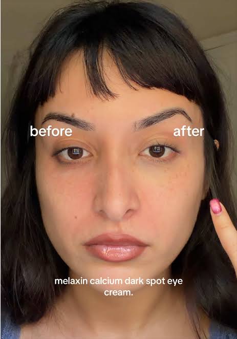 Dr Melaxin calcium- Dark spot cover eye cream